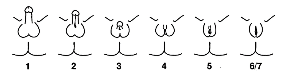 fig-semio-escala-quigley