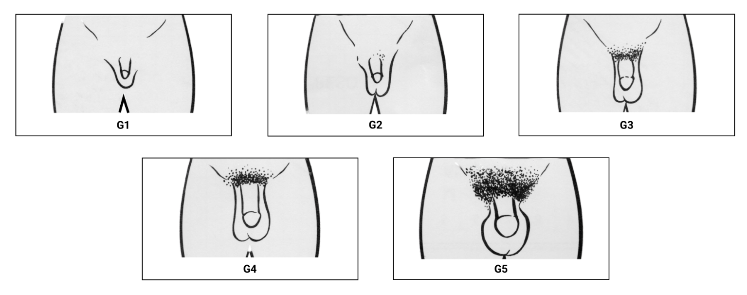 fig-semio-estadiamento-puberal-genitalia