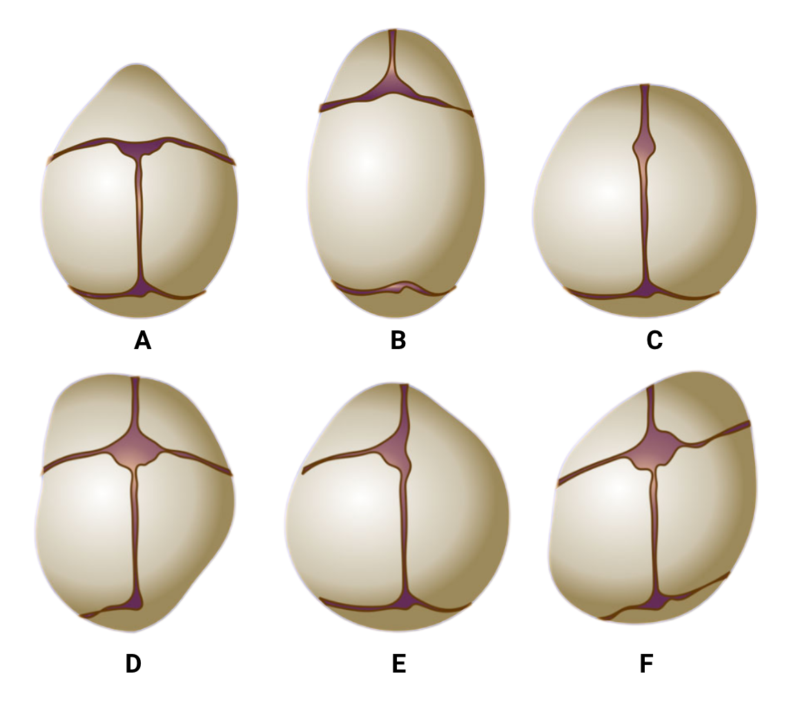 fig-semio-formato-craniio