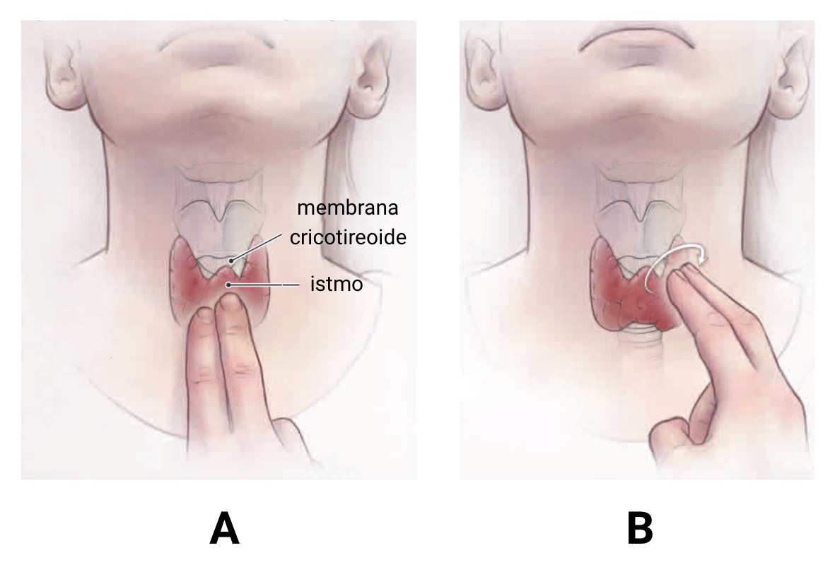 fig-semio-palpacao-tireoide